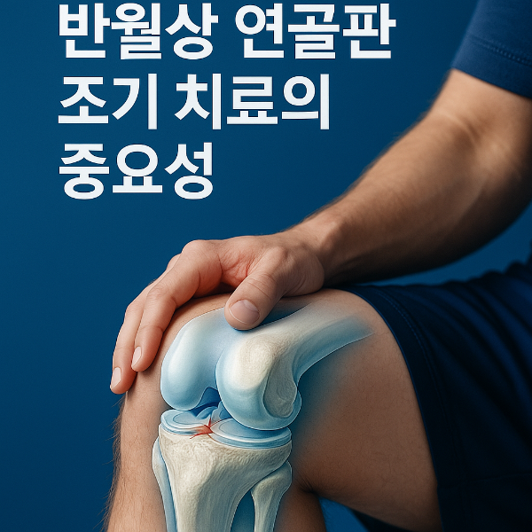 반월상 연골판 손상, 조기 치료가 퇴행성 관절염을 막는다