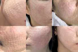 우리동네 잘하는피부과 선택법 |실력 있는 병원 찾는 핵심 포인트 관련사진