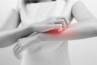 여름철 피부 가려움 원인 및 증상(+해결법) (2)