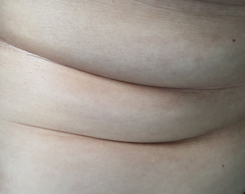 복부-지방으로-뱃살이-접힌-모습