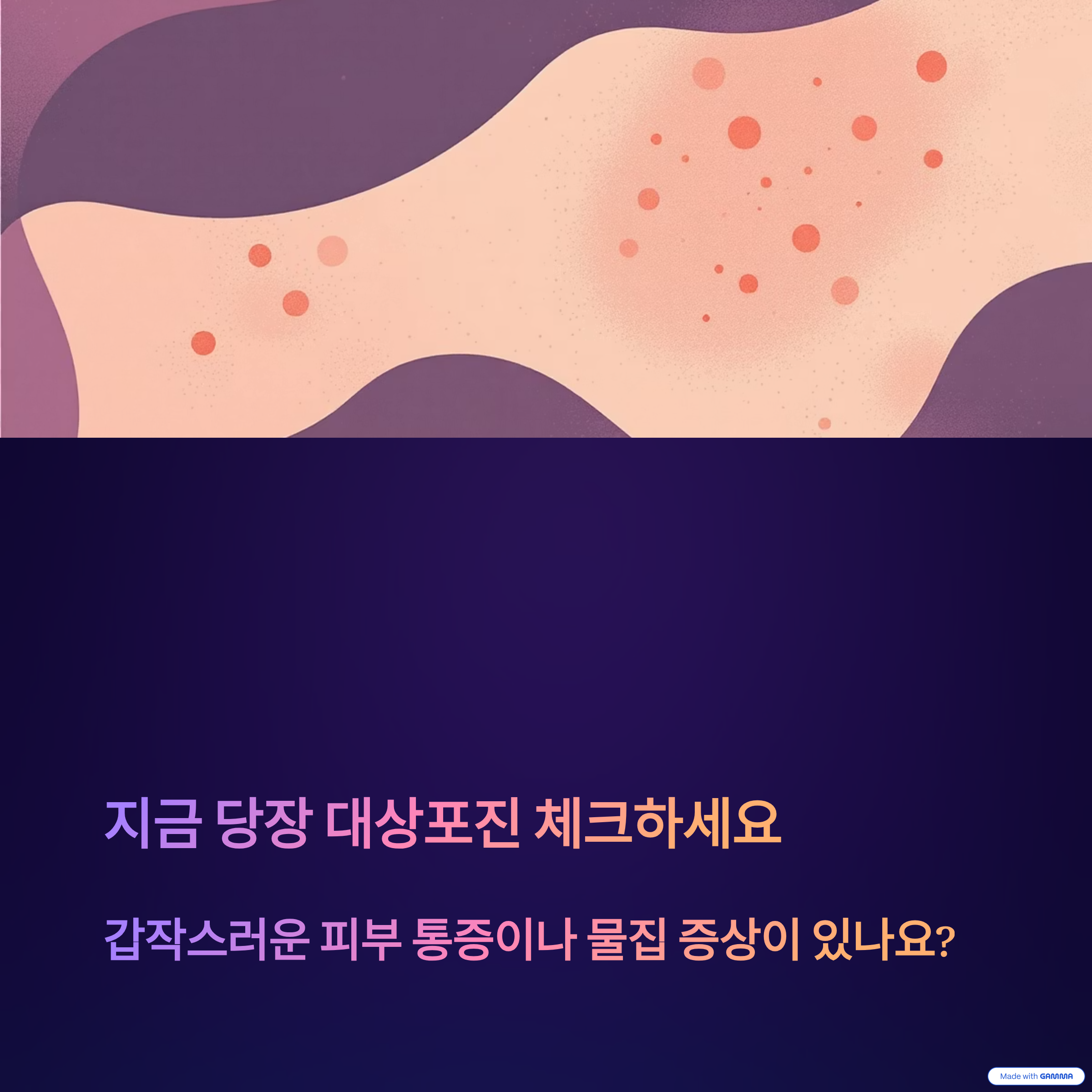 지금 당장 대상포진 체크하세요