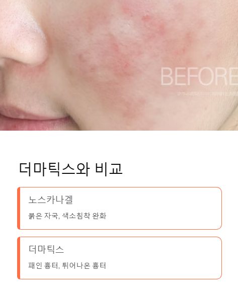 더마틱스와 비교