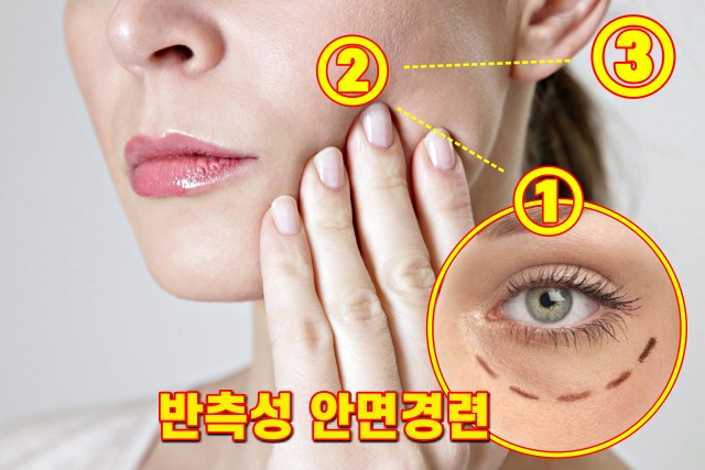 눈밑이 떨리는 증상 이유, 반측성 안면경련