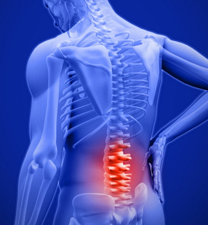 허리디스크 통증 완화 방법 : 삶의 질을 높이는 해결책 7가지와 걷기 운동