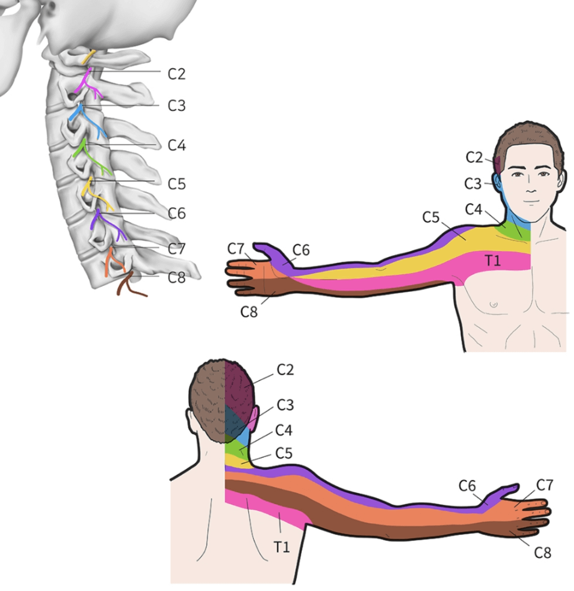 목디스크 증상 팔저림