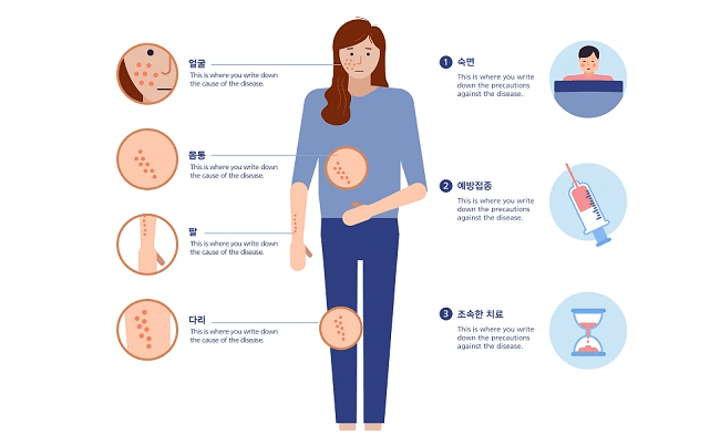 인천광역시 - 미추홀구 대상포진