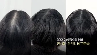 정수리가 아픈 이유와 완화하는 방법_21