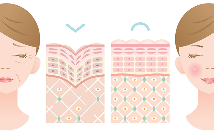 탄력있는 피부와 그렇지 못한 피부의 차이