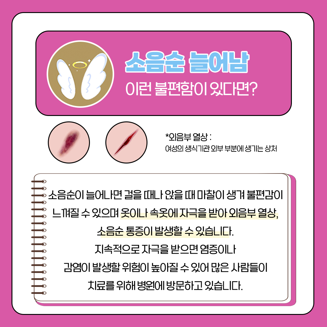 소음순 늘어남 이런 불편함이 있다면?