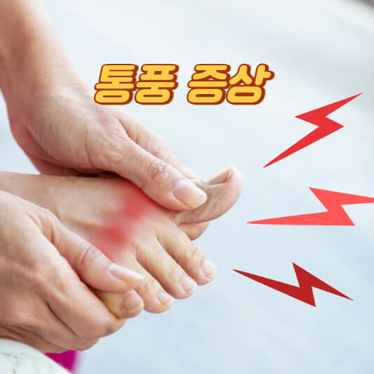 통풍 증상