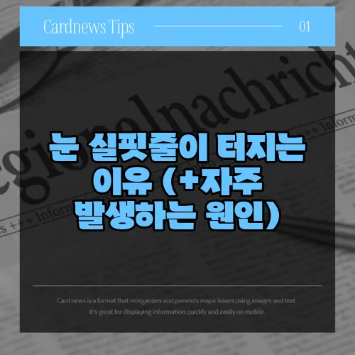 눈 실핏줄이 터지는 이유 (+자주 발생하는 원인)