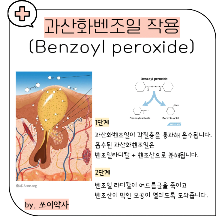 파티마겔 성분 과산화벤조일
