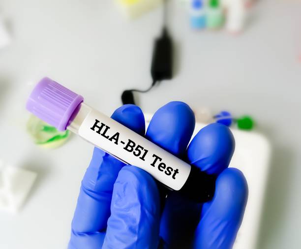 HLA-B51