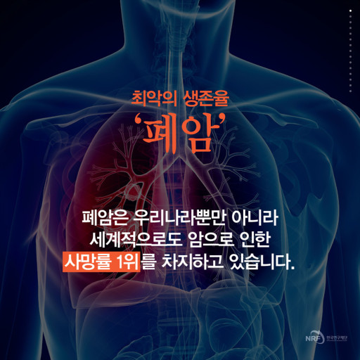 호흡기 질환: 폐암- 초기증상, 원인, 1기~말기까지 진행과정, 치료방법, 수술방법.