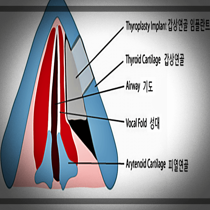 갑상선-부위-상세-자료
