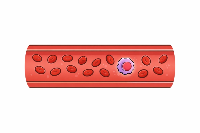 암환자 산정특례 제도