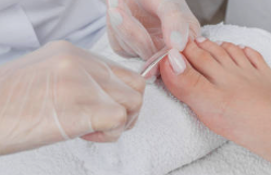 내성발톱 자가치료 교정기 내성발톱 수술 테이프 제품 추천