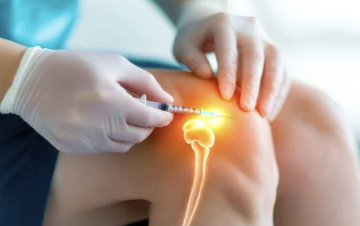 스테로이드 주사