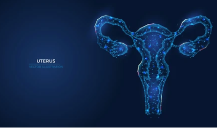 자궁암 4기 생존율