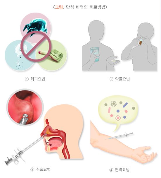 만성비염-치료방법을-설명하는-그림