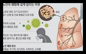 폐렴 예방접종 가격 시기