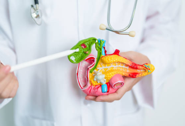 담석증 치료 및 수술 방법 (+ 담석증 원인 증상 수술 후유증)