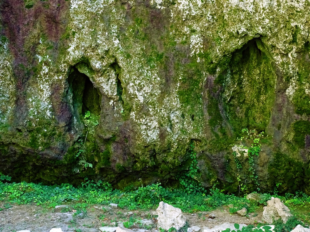 Lower abdomen.