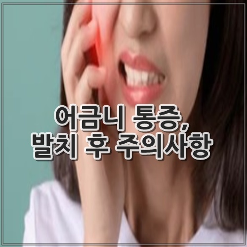 어금니 통증, 발치 후 주의사항