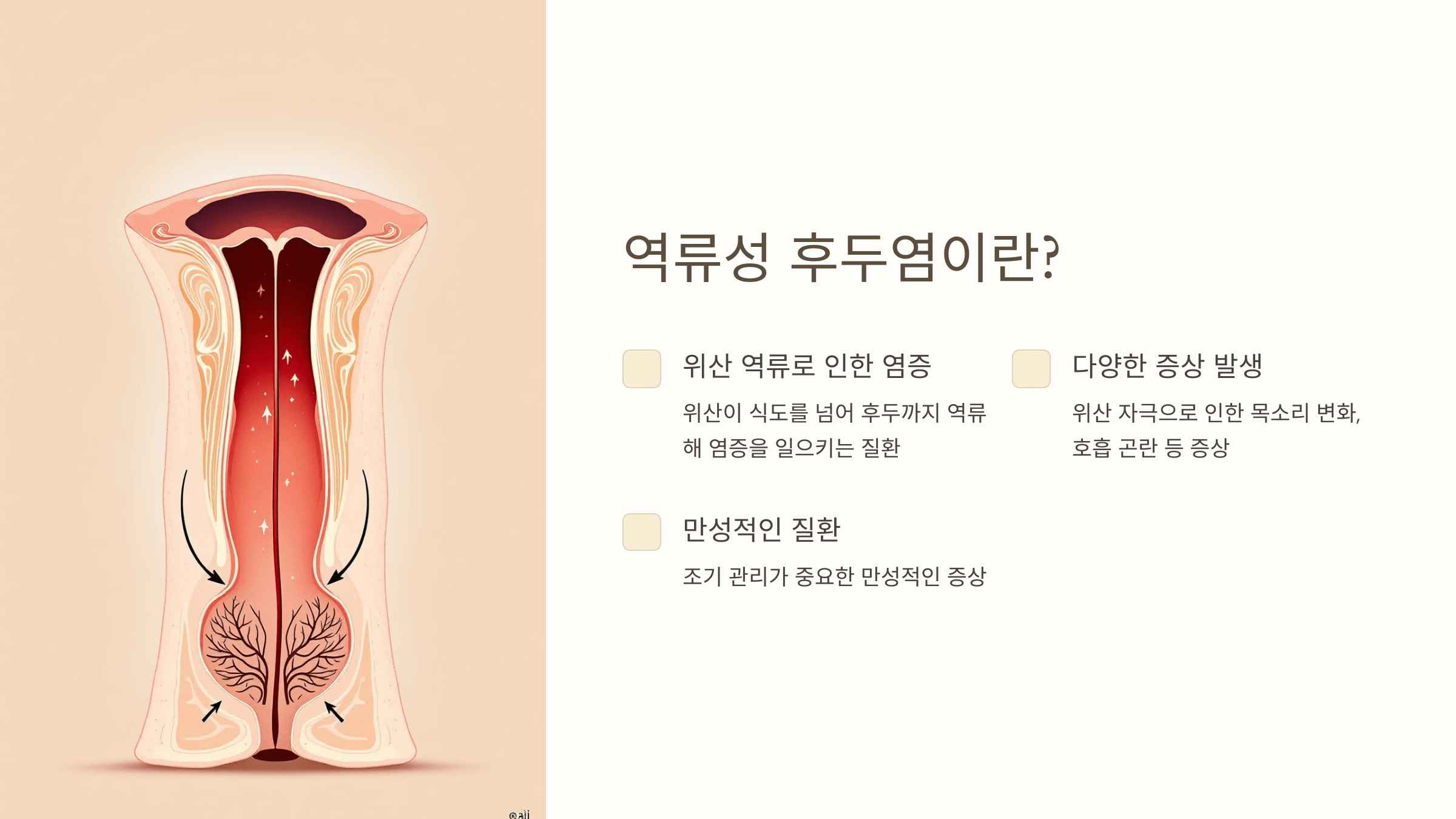 역류성 후두염과 관련된 사진입니다.