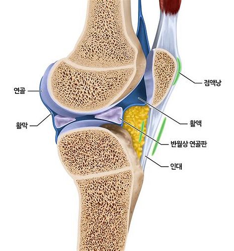 관절주사