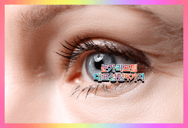 눈성형 비용 가격