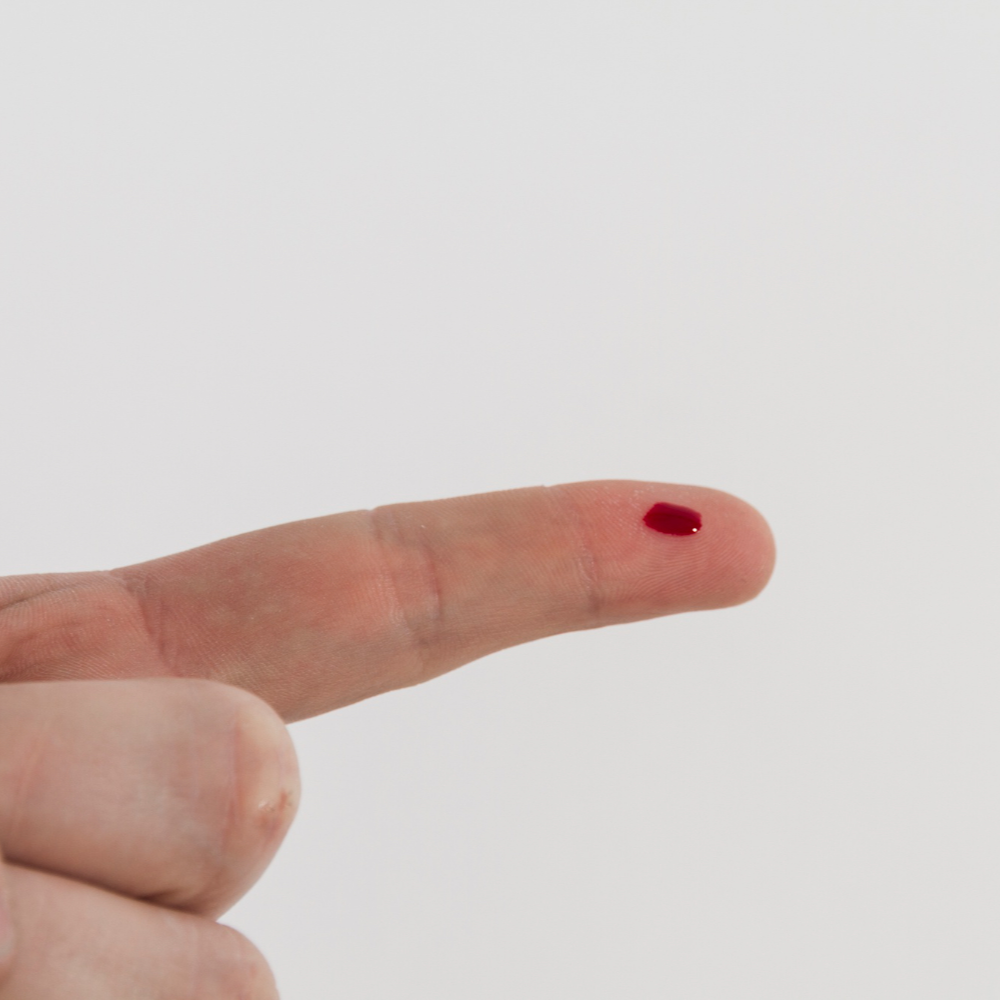 동남아에서도 성조숙증 치료 가능할까?