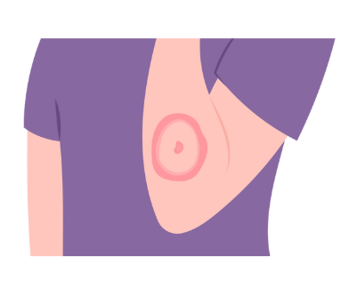 대상포진 예방접종 가격 무료 대상