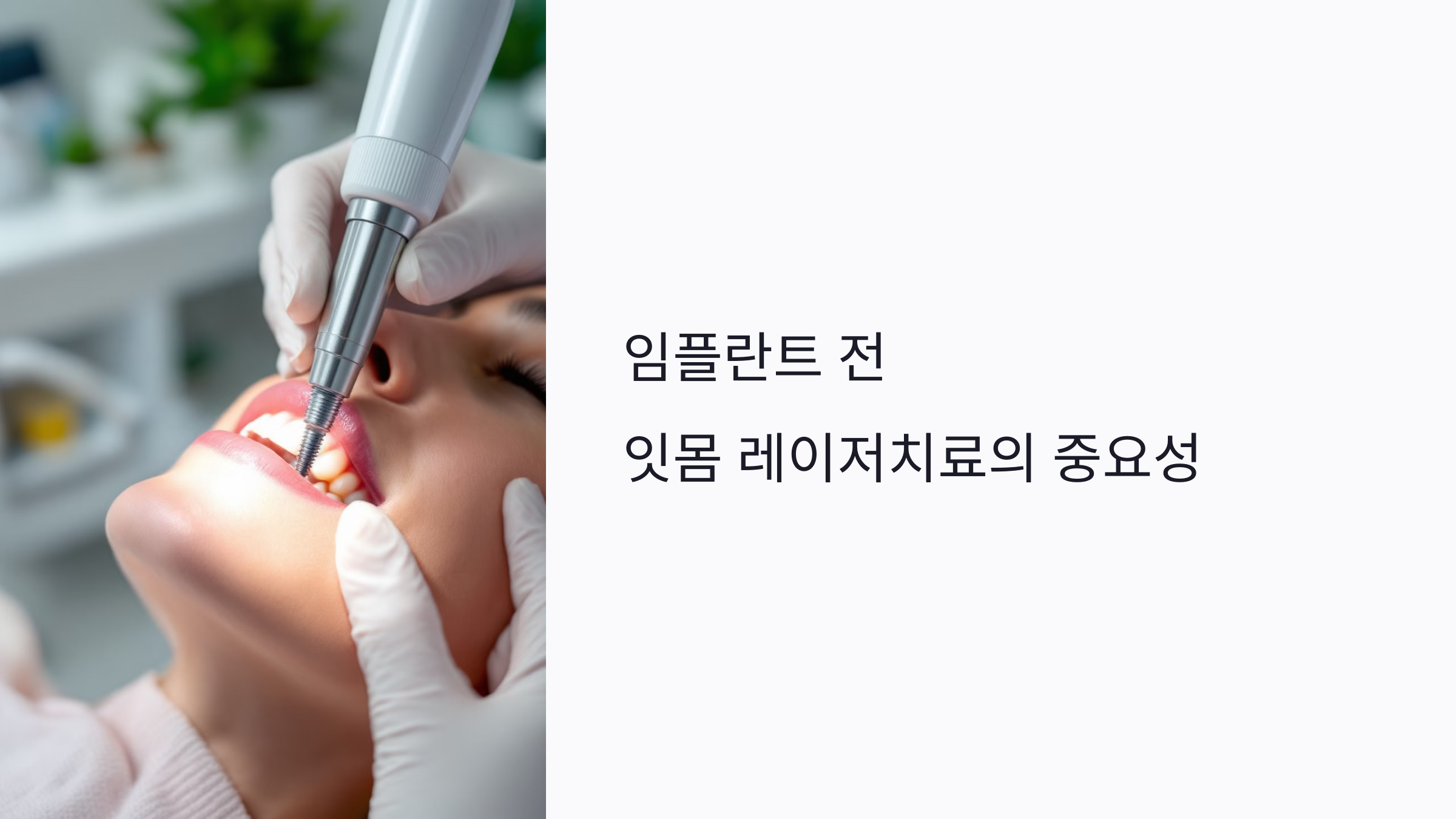 임플란트 전 잇몸 레이저치료, 왜 먼저 해야 할까? 실패 예방부터 회복까지