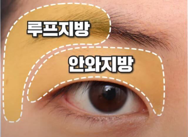 루프지방, 안와지방 위치