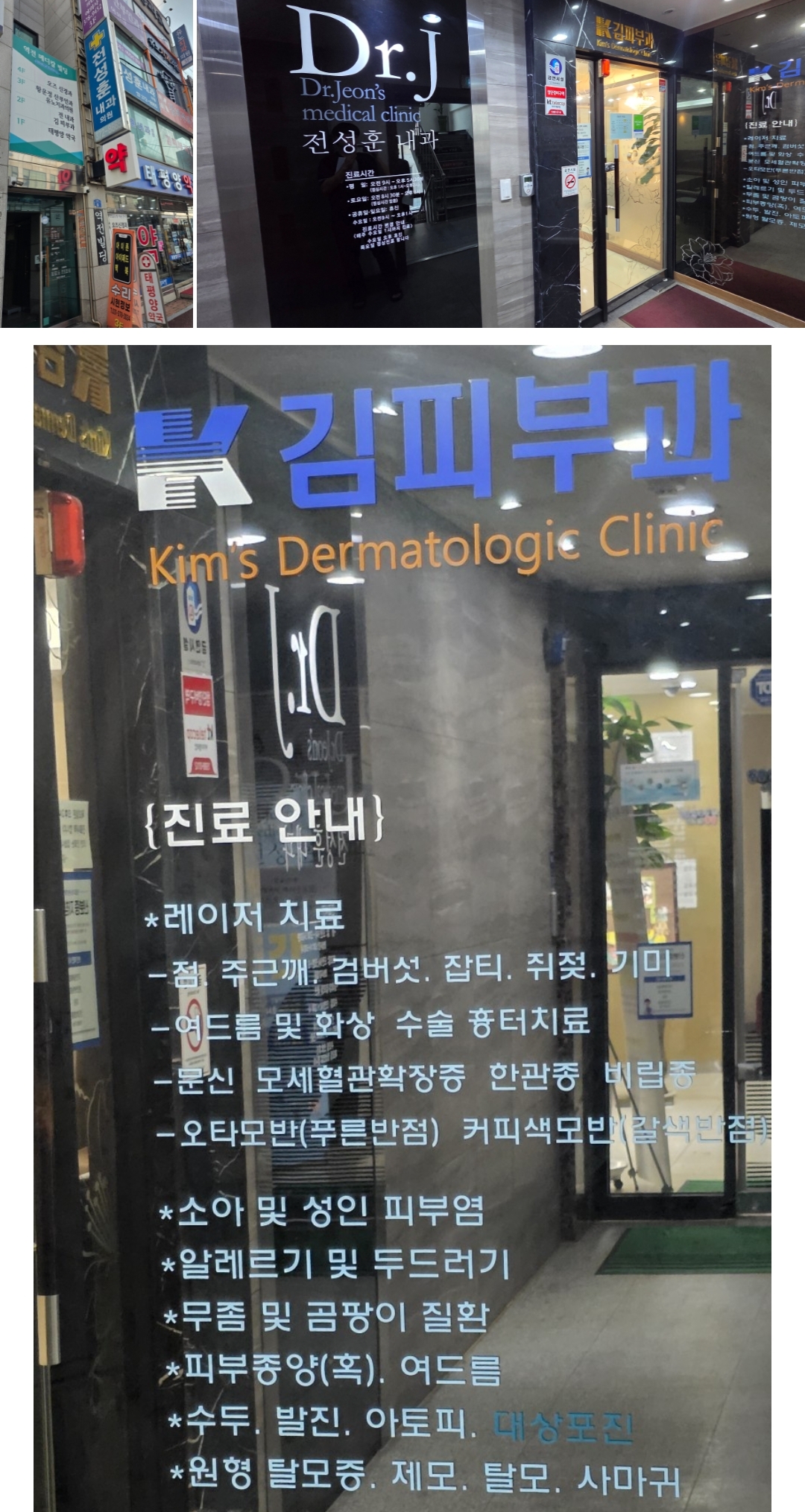 운동 후/더위 먹은 후 얼굴이 벌개지고 부을 때(김피부과)