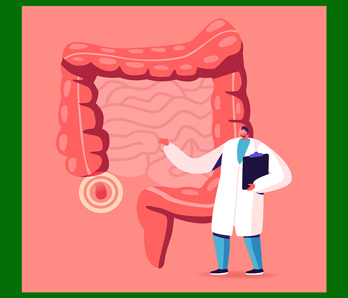 녹색변 원인 - 염증성 장질환