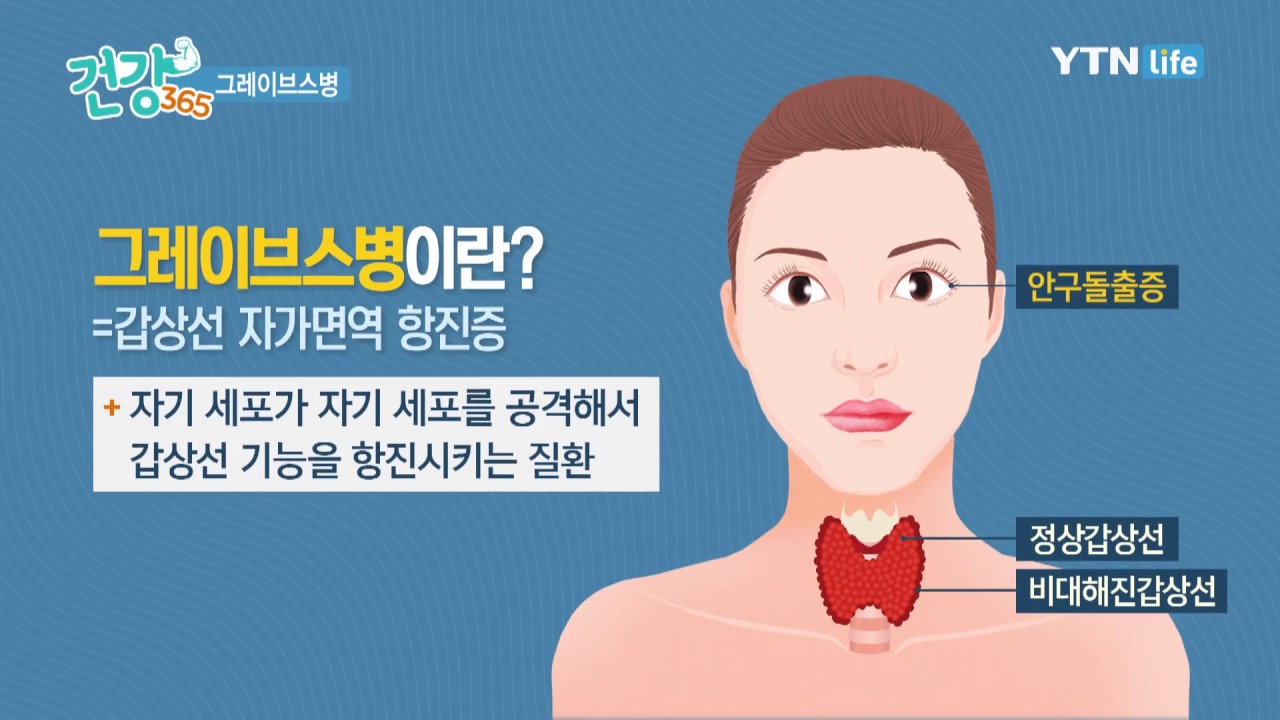 그레이브스병이란?