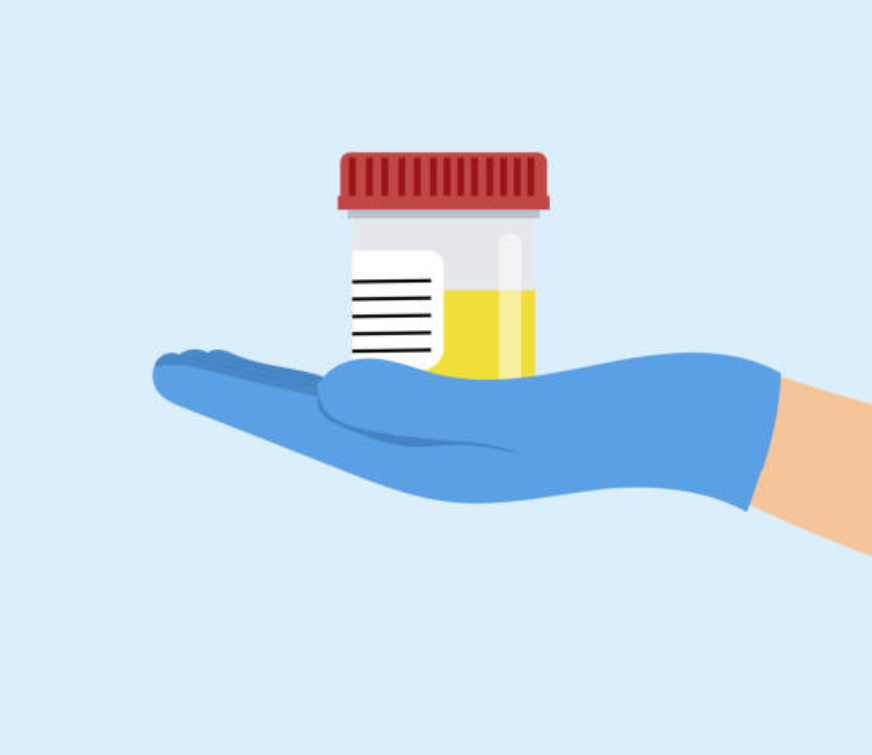 여자소변거품-사진1