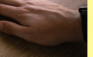 성홍열유행주의