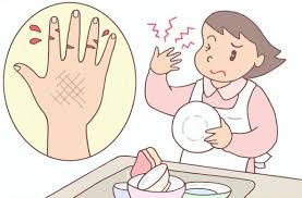 비립종 없애는 방법