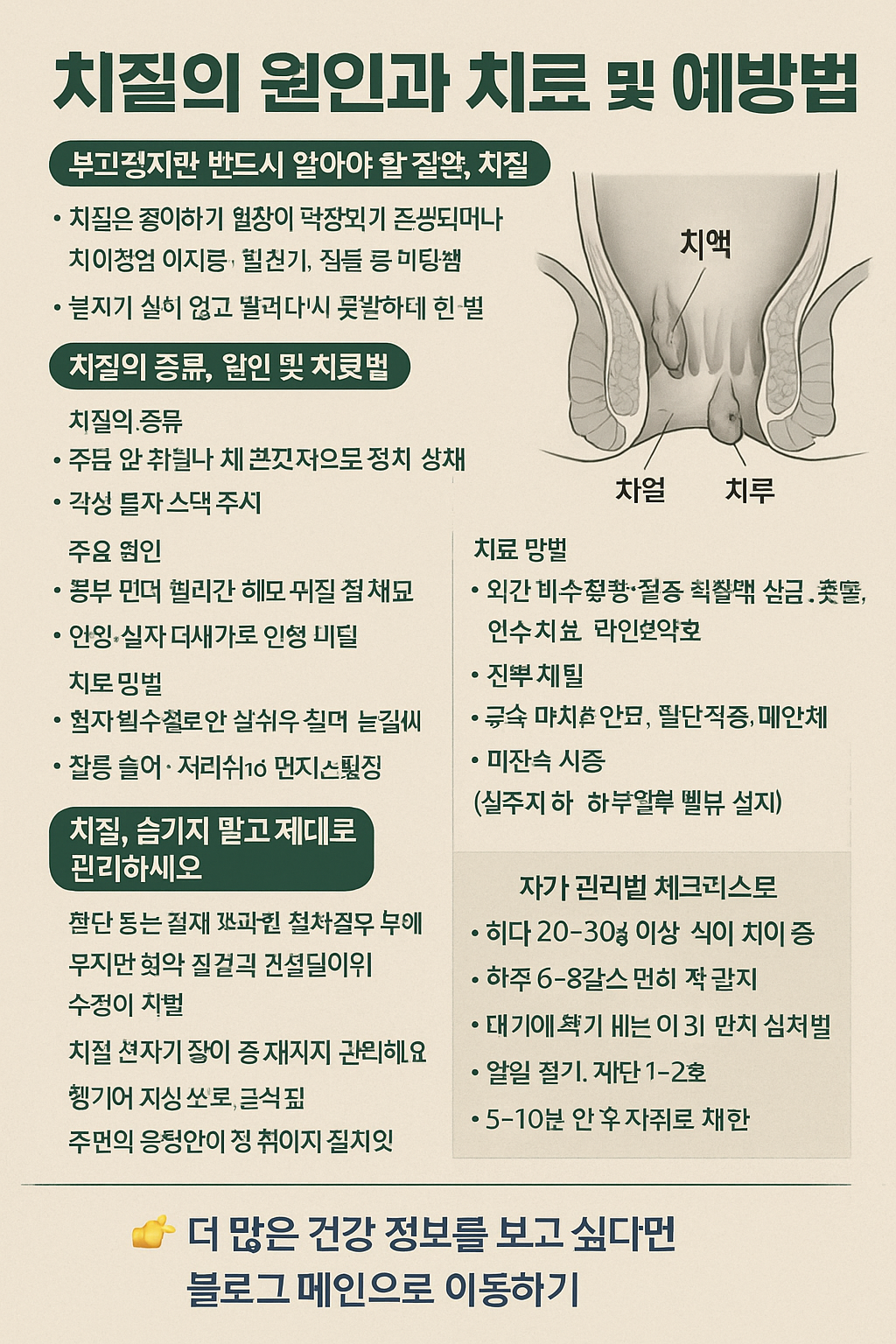 치질의 원인과 치료 및 예방법 사진
