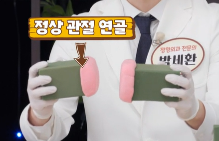 콘드로이친 효능