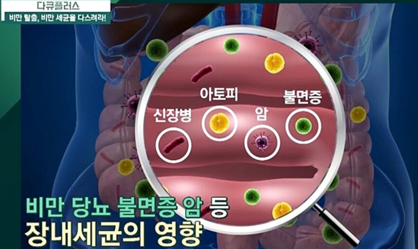 비만증상