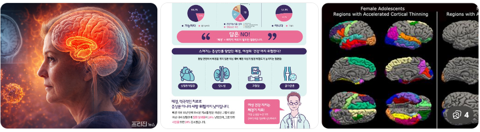 폐경과 알츠하이머 뇌 변화의 관계 관련 이미지