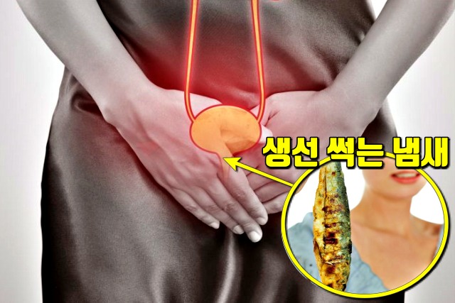 소변에서 냄새가 나는 이유 생선썩는냄새 전립선염 질염, 건강 팁줌