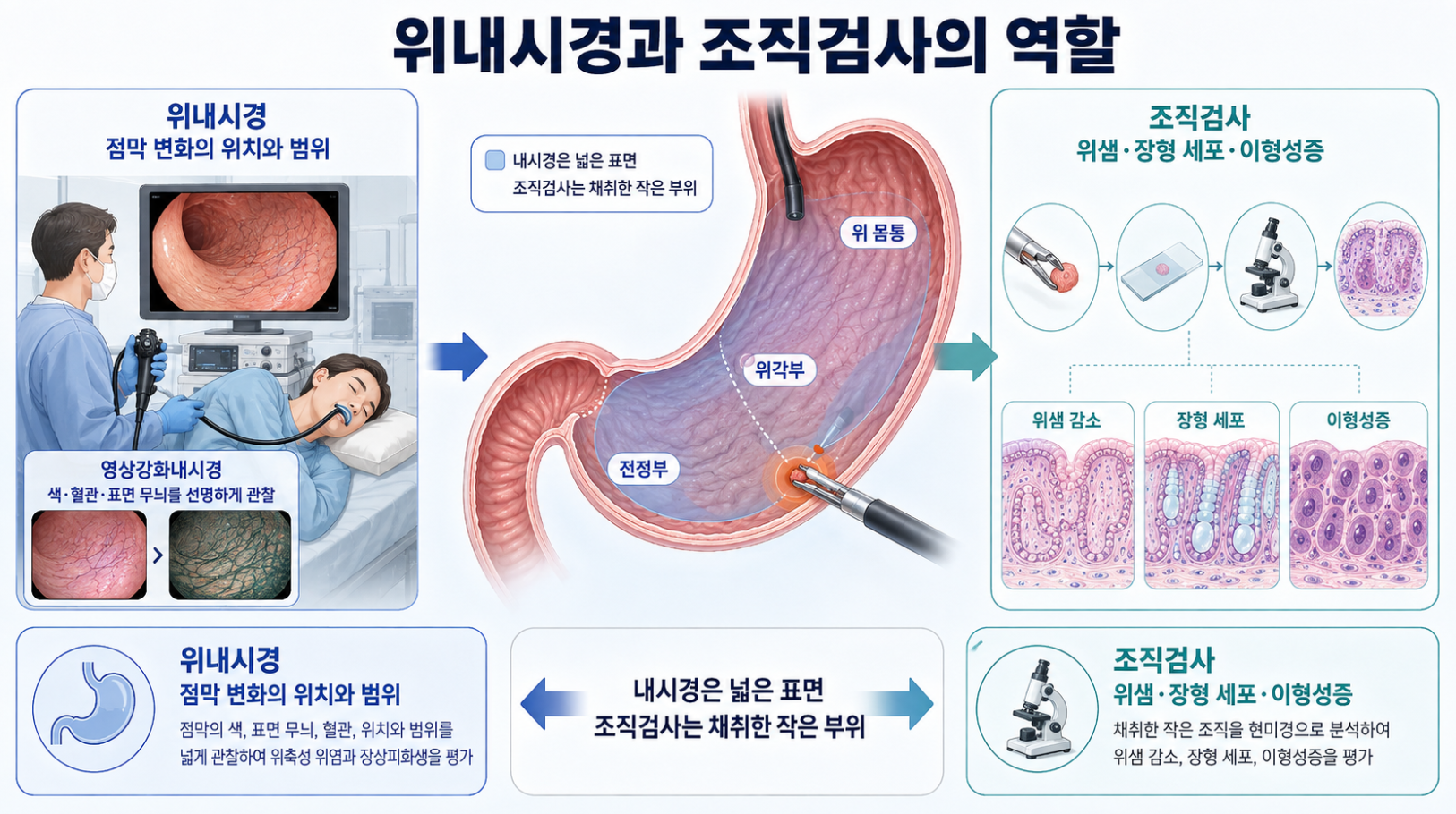 위내시경의 점막 관찰 범위와 조직검사의 위샘·세포 구조 평가 역할을 비교한 인포그래픽