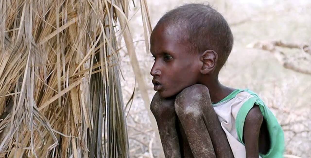 앙상하게 말라버린 아이