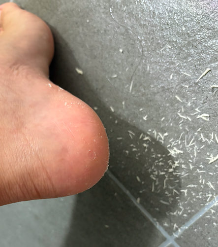 바렌 각질제거기 추천 내돈내산 사용후기1