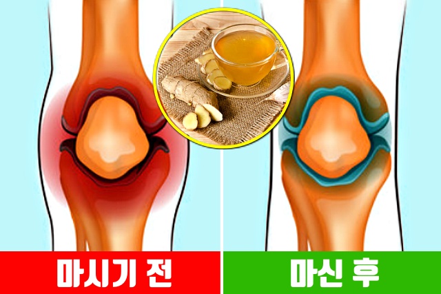 생강차 효능 무릎 통증 관절염에 좋은 음식 생강 효능,건강 팁줌 매일꿀정보